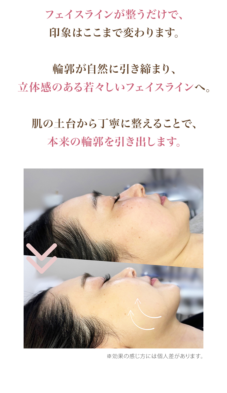 ビフォーアフター1